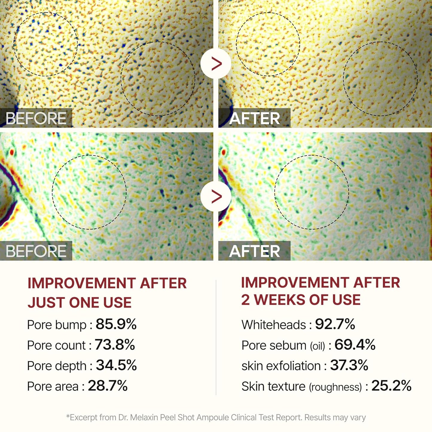 Radiant Glow Exfoliating Ampoule Duo™