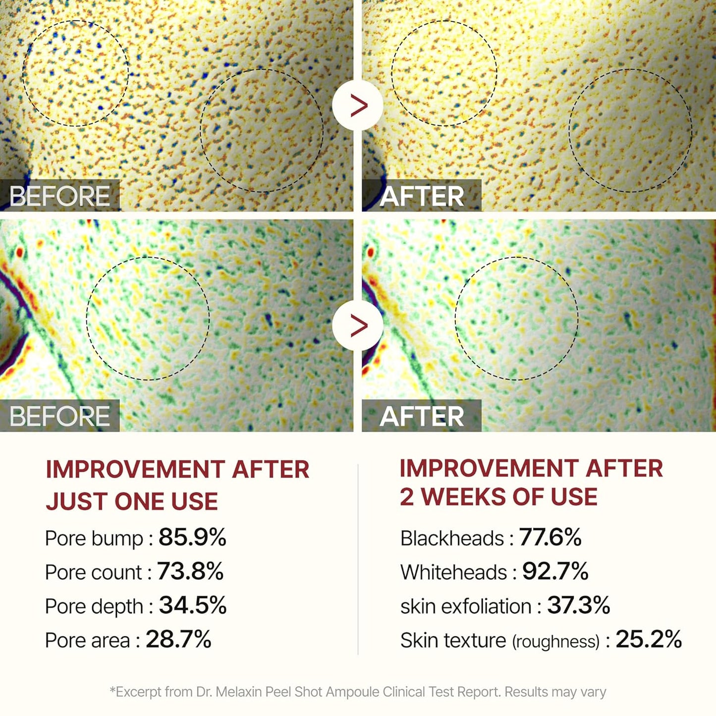 Radiant Glow Exfoliating Ampoule Duo™