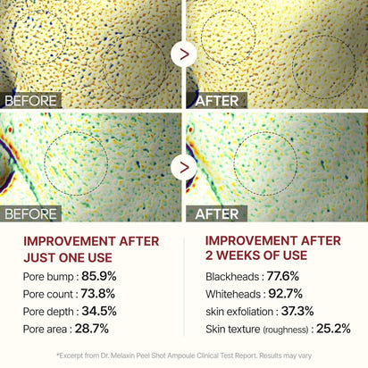 Radiant Glow Exfoliating Ampoule Duo™