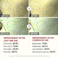 Radiant Glow Exfoliating Ampoule Duo™