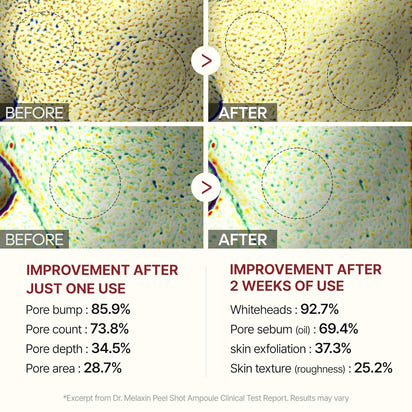 Radiant Glow Exfoliating Ampoule Duo™