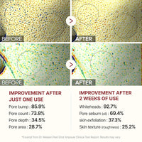 Radiant Glow Exfoliating Ampoule Duo™